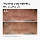 ord-niacinamide-zinc-blemish-serum-before-after-pores