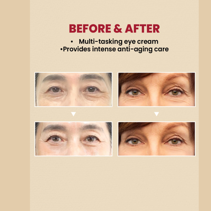 KSECRET SEOUL 1988 Eye Cream - Retinal Liposome 4% + Fermented Bean 3