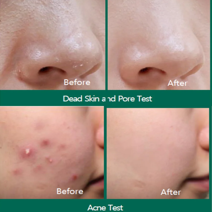 Some By Mi Miracle Cream 2