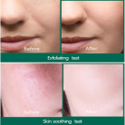 Some By Mi Miracle Serum 3