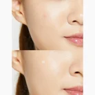 COSRX-Acne-Pimple-Master-Patch-3.webp