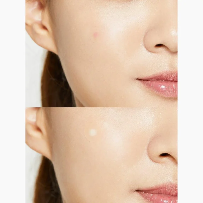 COSRX-Acne-Pimple-Master-Patch-3.webp
