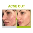 Purito-Azelaic-Acid-10-Kojic-Tea-Tree-Serum-2.webp