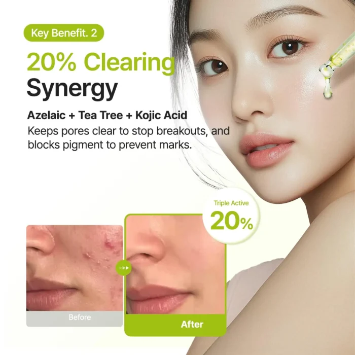 Purito-Azelaic-Acid-10-Kojic-Tea-Tree-Serum-4.webp