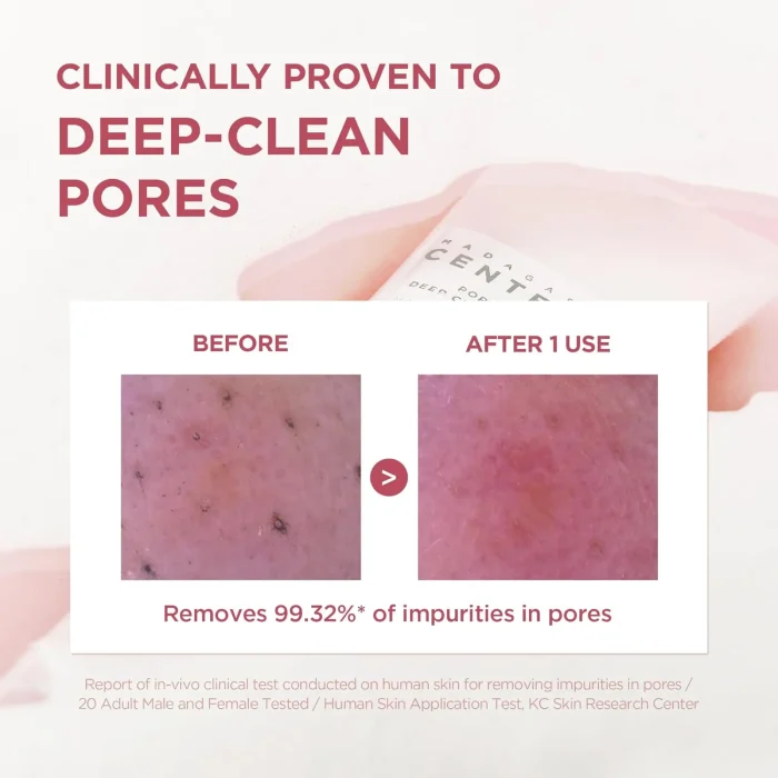 SKIN-1004-Madagascar-Centella-Poremizing-Deep-Cleansing-Foam-6.webp