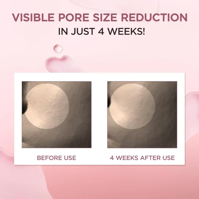 SKIN-1004-Madagascar-Centella-Poremizing-Fresh-Ampoule-3.webp