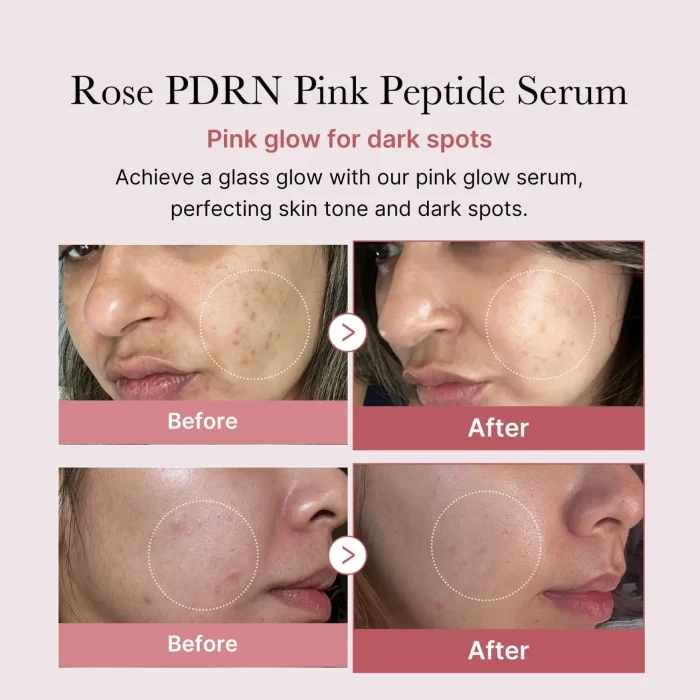 medicube-PDRN-Pink-Peptide-Serum-3.webp