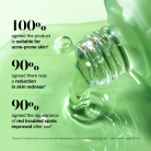 Anua-Azelaic-Acid-10-Hyaluron-Redness-Soothing-Serum-3.webp