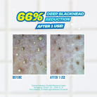 JUMISO-Blackhead-Melting-Softener-2.webp