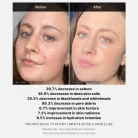 Medicube-Red-Acne-Succinic-Acid-Peel-3.webp