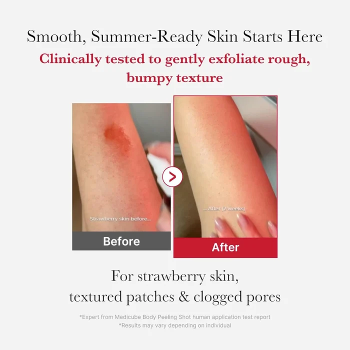 Medicube-Red-Body-Peeling-Shot-Cleanser-3.webp