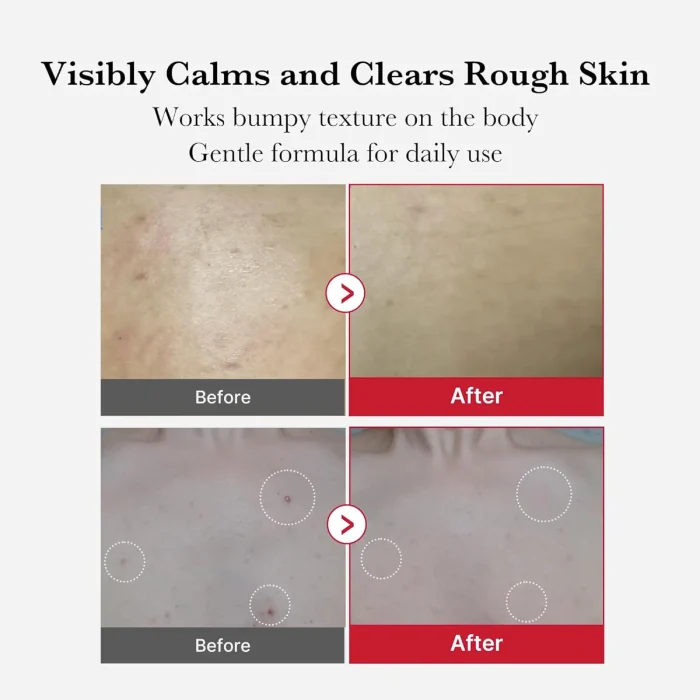 Medicube-Red-Body-Peeling-Shot-Cleanser-7.webp