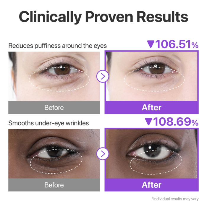 No.9-NAD-Collagen-Under-Eye-Patches-3.webp