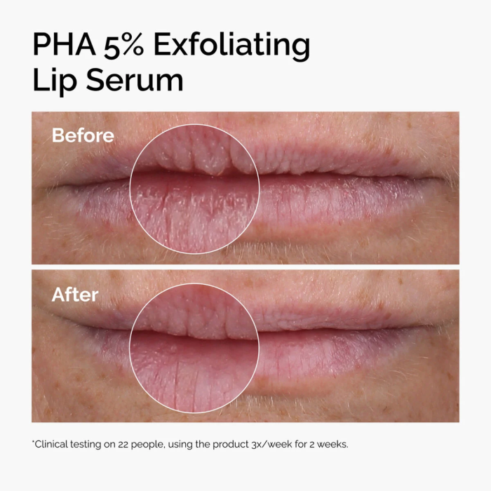 The-Ordinary-PHA-5-Exfoliating-Lip-Serum-2.webp